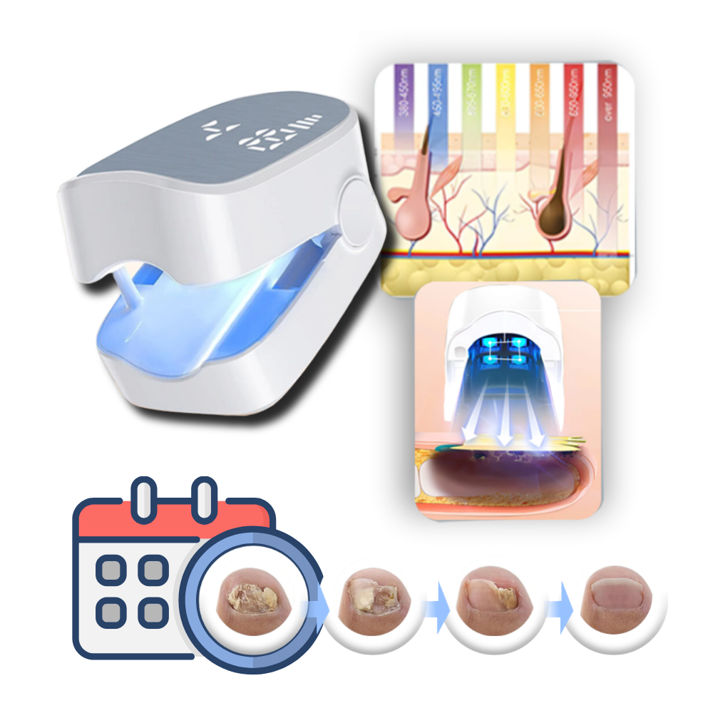 Painless laser treatment for nail fungus