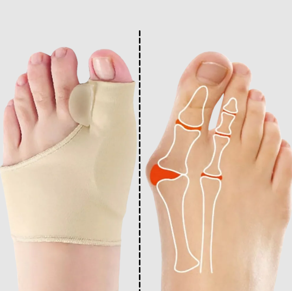 Gel bunion corrector